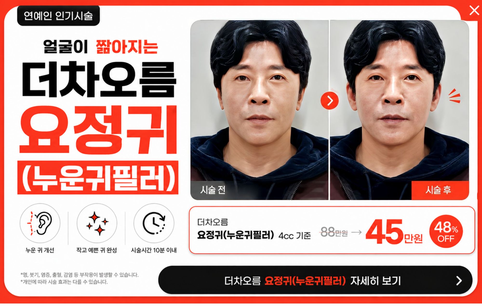 팝업이미지